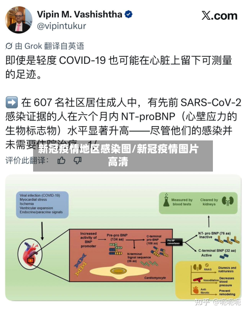 新冠疫情地区感染图/新冠疫情图片高清-第1张图片
