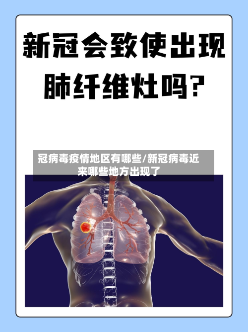 冠病毒疫情地区有哪些/新冠病毒近来哪些地方出现了
