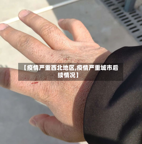 【疫情严重西北地区,疫情严重城市后续情况】